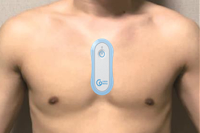 48-hour long-term Holter electrocardiogram examination